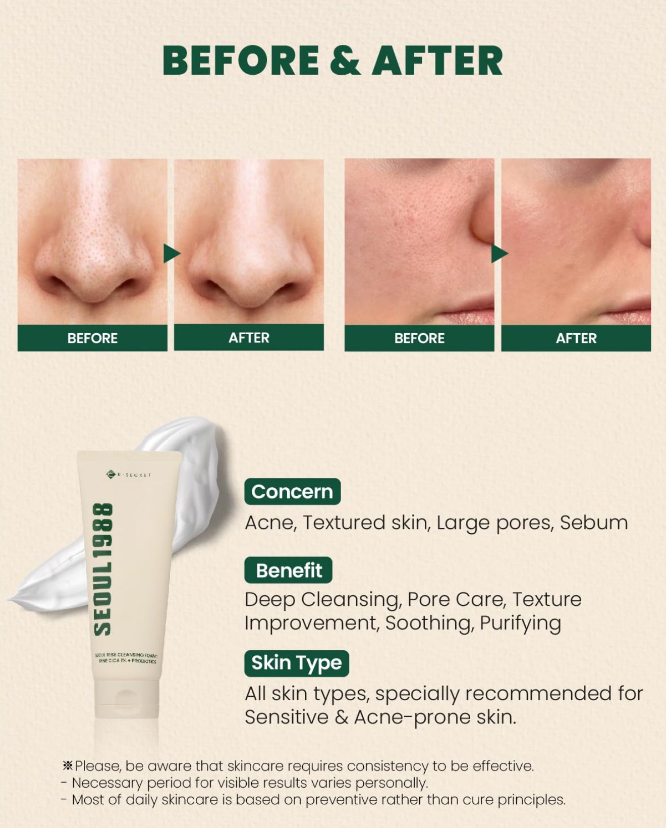K-SECRET Seoul 1988 Cleansing Foam Fine Cica 1% + Probiotics (150ml)