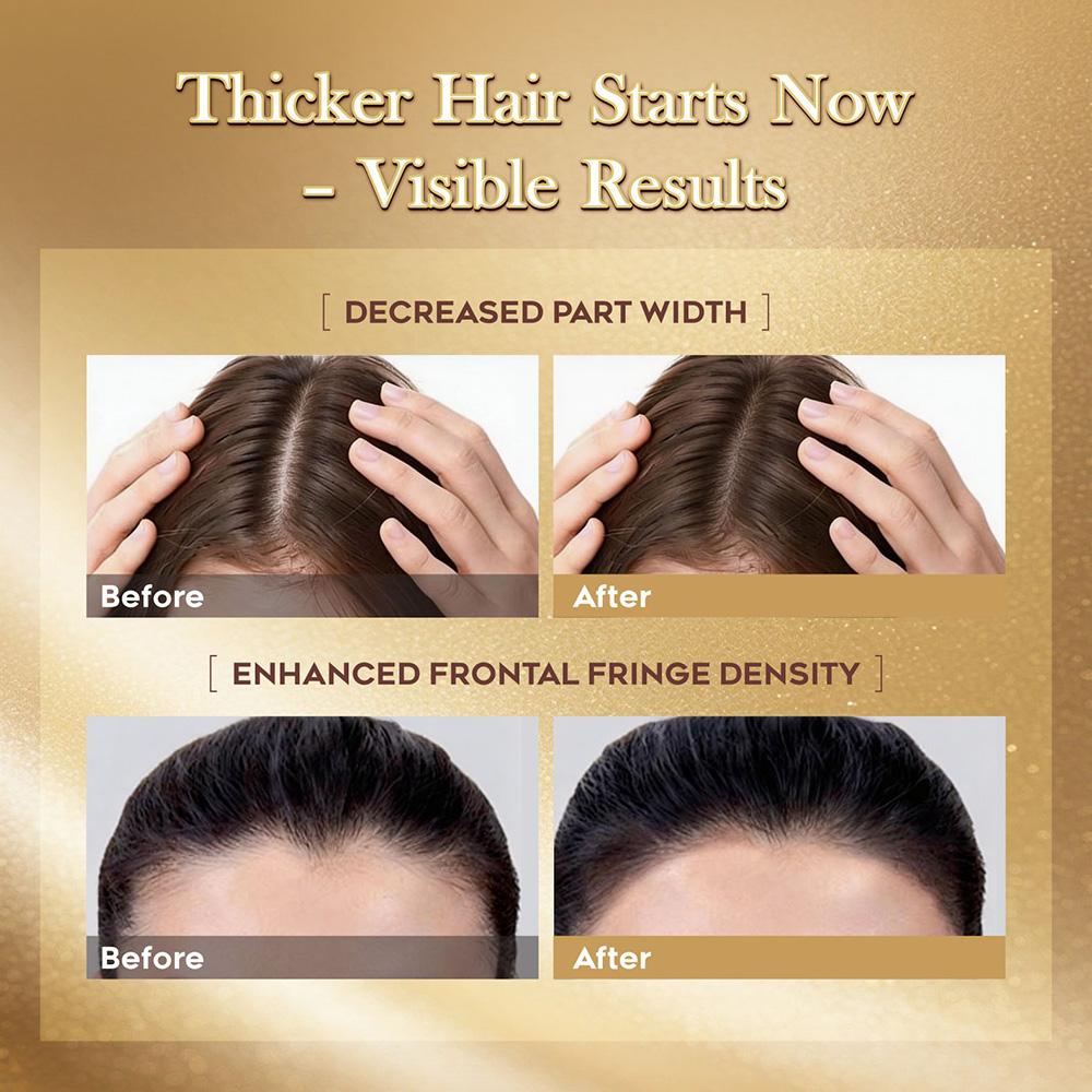Lumei Rosemary Infused Hair Growth Support Serum(30ml)