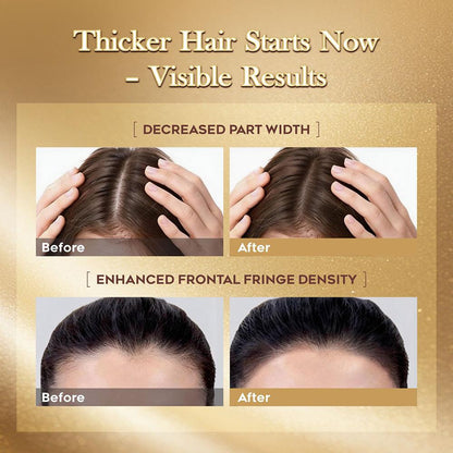 Lumei Rosemary Infused Hair Growth Support Serum(30ml)
