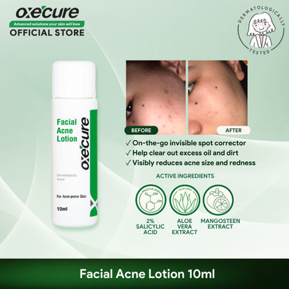 Oxecure Facial Acne Lotion (10ml)