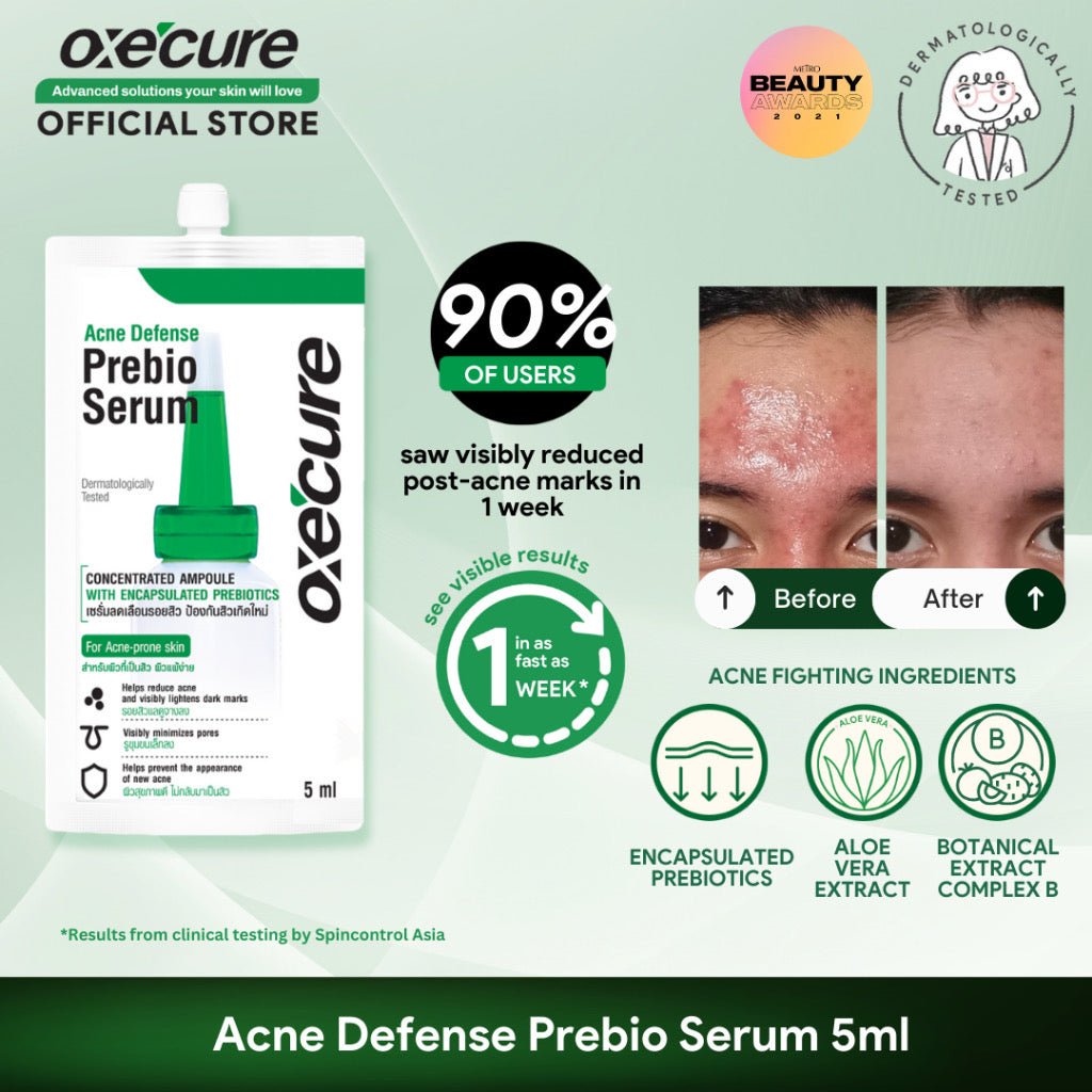 Oxecure Acne Defense Prebio Serum (5ml)