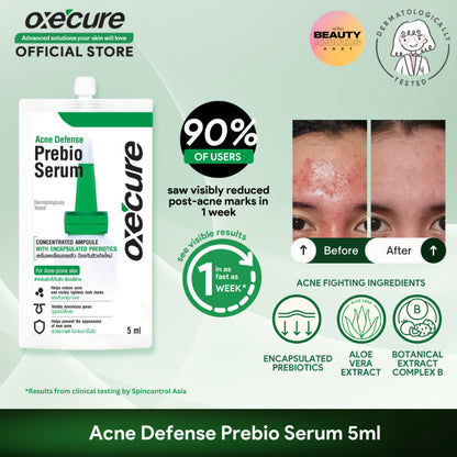 Oxecure Acne Defense Prebio Serum (5ml)