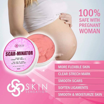 Scarminator Cream by Skin Sensation (40ml)