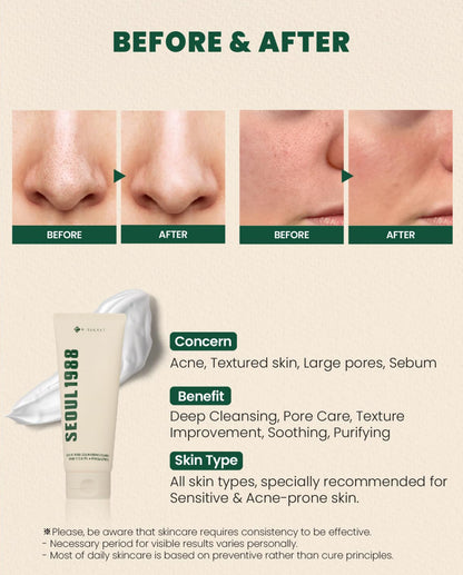 K-SECRET Seoul 1988 Cleansing Foam Fine Cica 1% + Probiotics (150ml)